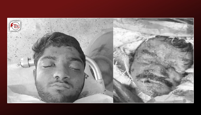 لسبیلہ ءَ دو جون دز کپتگ