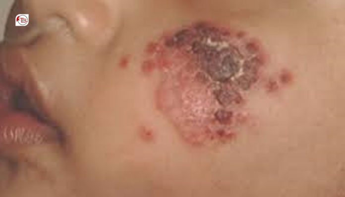 بلوچستان ءَ لشمینا ءِ نادراھی تالان بوھان انت