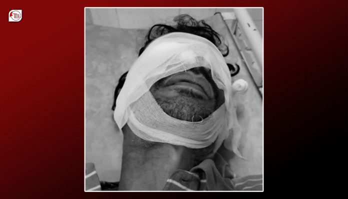 کیچ ءَ دگہ یک مردمے ءَ وتکشی کتگ