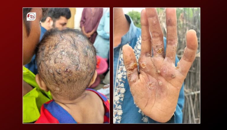 کلات ءَ لشمینیا ءِ نادراھی ءِ تیزی ءَ گوں شنگ بوان انت